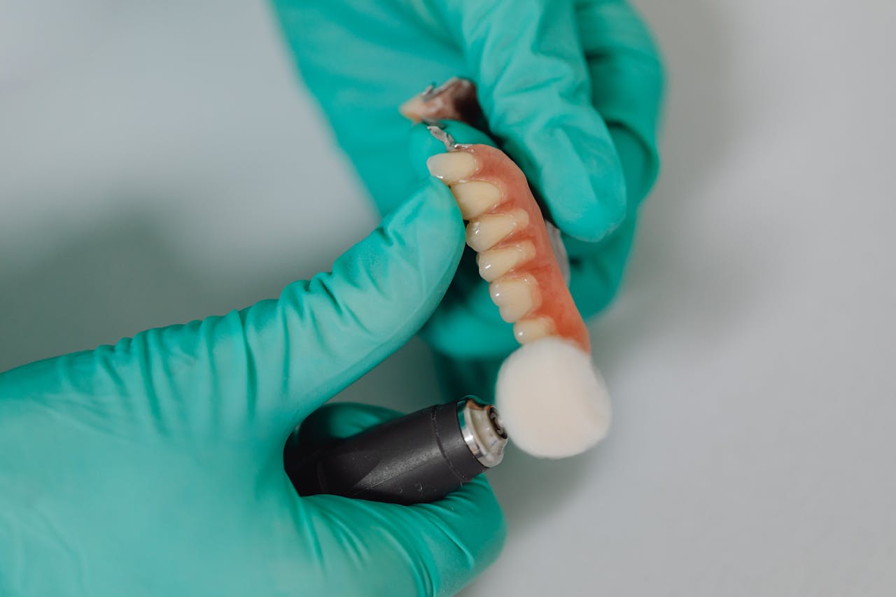 Dental Implant Experience