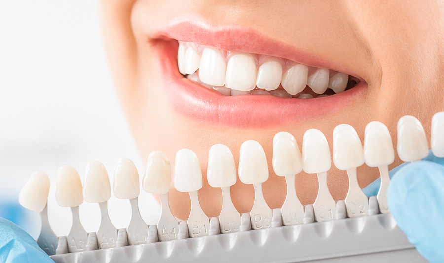 Enhance Your Smile with Cosmetic Dentistry in San Francisco, CA
